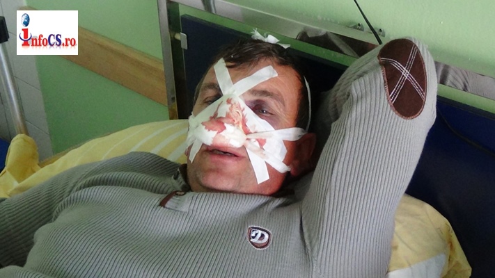 VIDEO FOTO Primarul Petru Lorinț din Domașnea, i-a spart fața  la propriu unui consătean