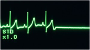 EKG linie