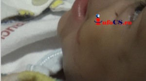 Copil batut (9)
