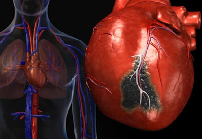 Afectiunie cardiace si tensiunea arteriala omoara carasenii