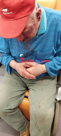 De la bal – La spital.  Bărbat de 65 de ani desfigurat în bătaie și cu fracturi craniene de prietenii de pahar VIDEO EXCLUSIV